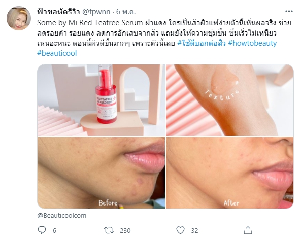 รีวิวจากผู้ใช้จริง Some By Mi Red Teatree Cicassoside Final Solution Serum